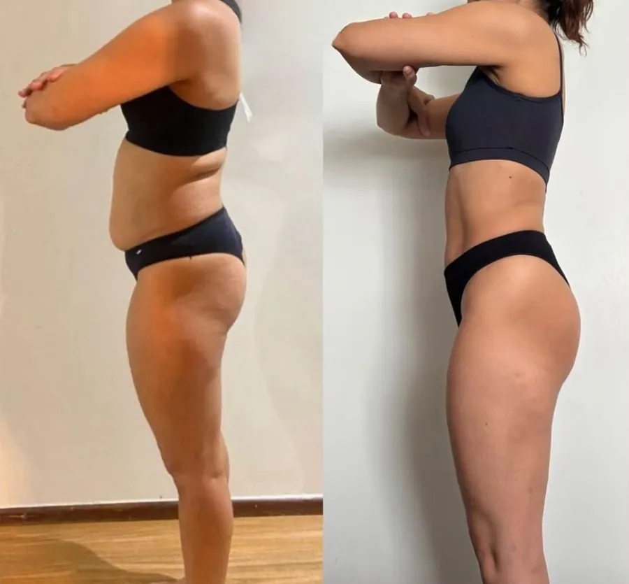 Evolução real 04, antes e depois